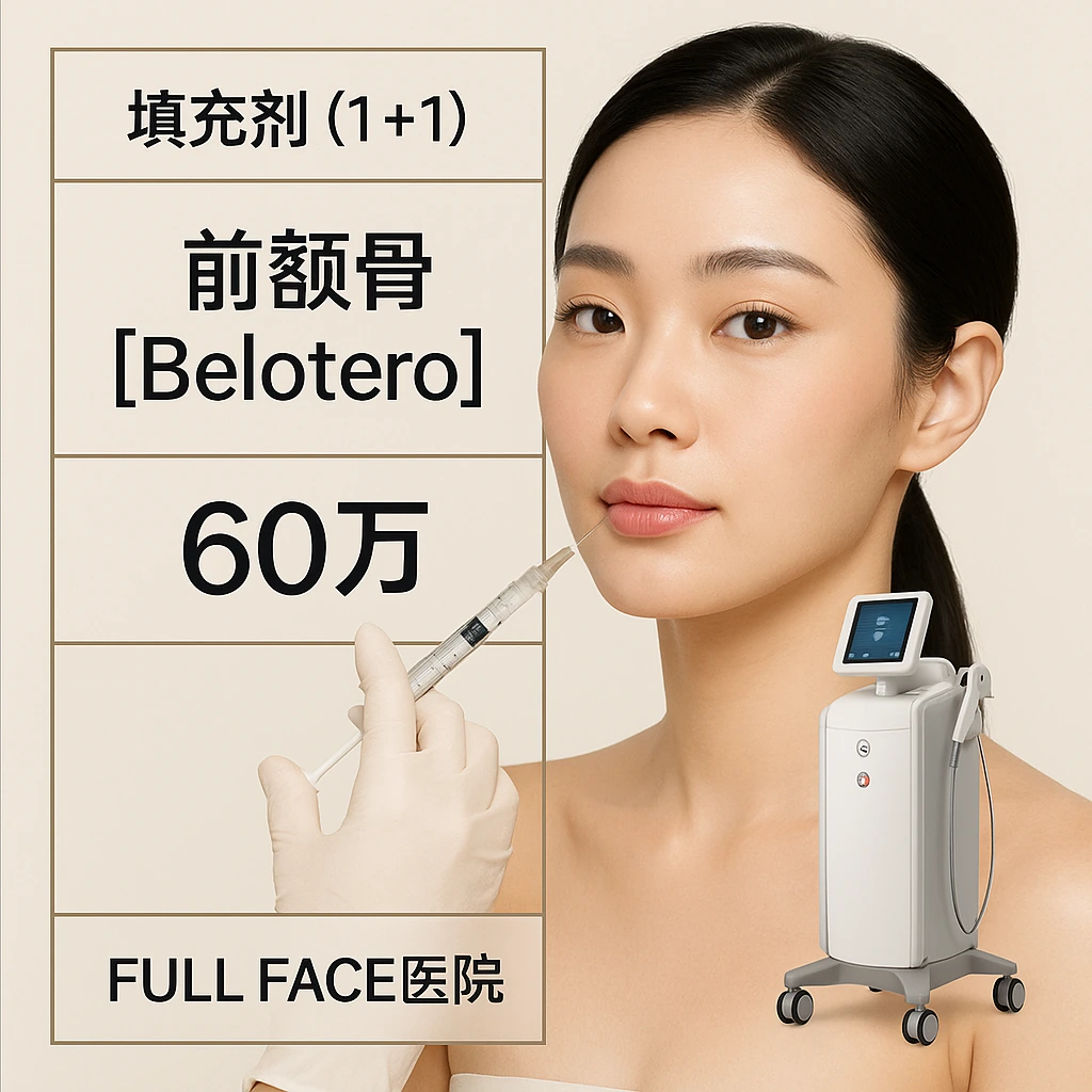 前颧骨【Belotero】