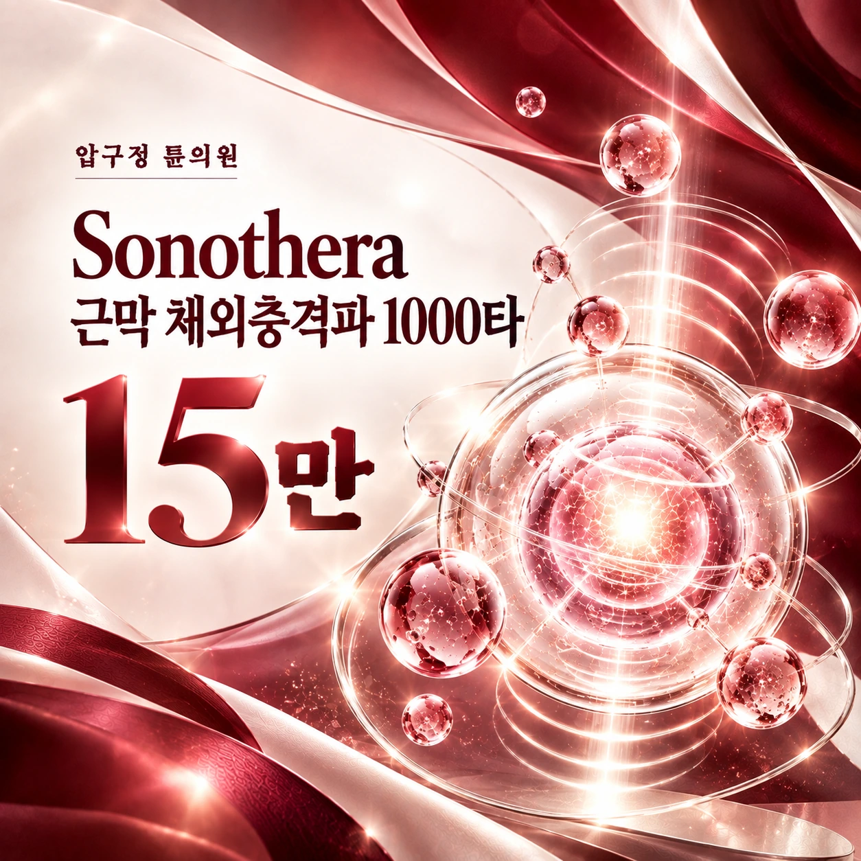 Sonothera 근막 체외충격파 1000타