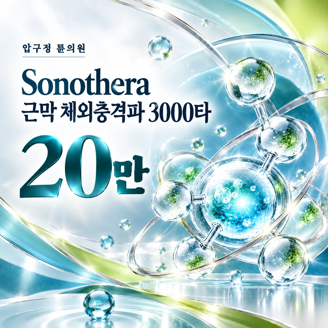 Sonothera 근막 체외충격파 3000타