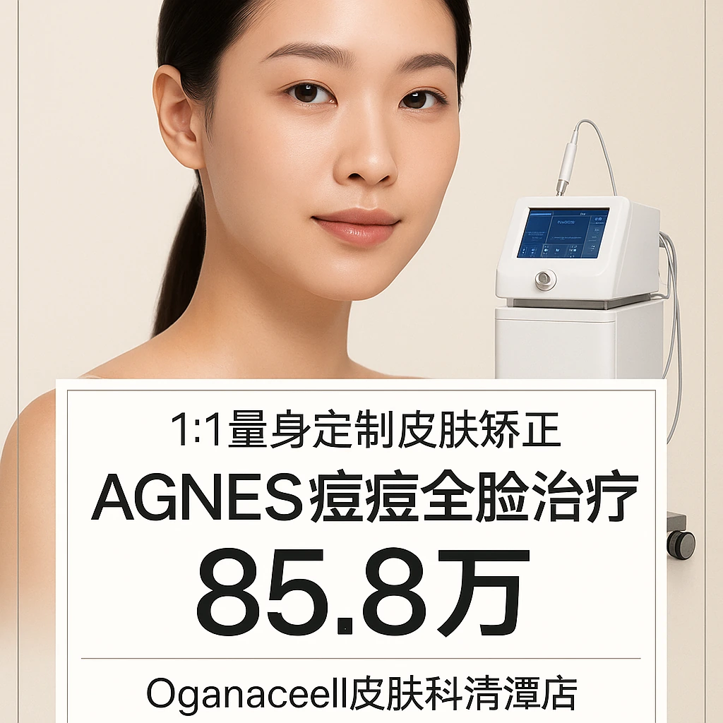 AGNES痘痘全脸治疗
