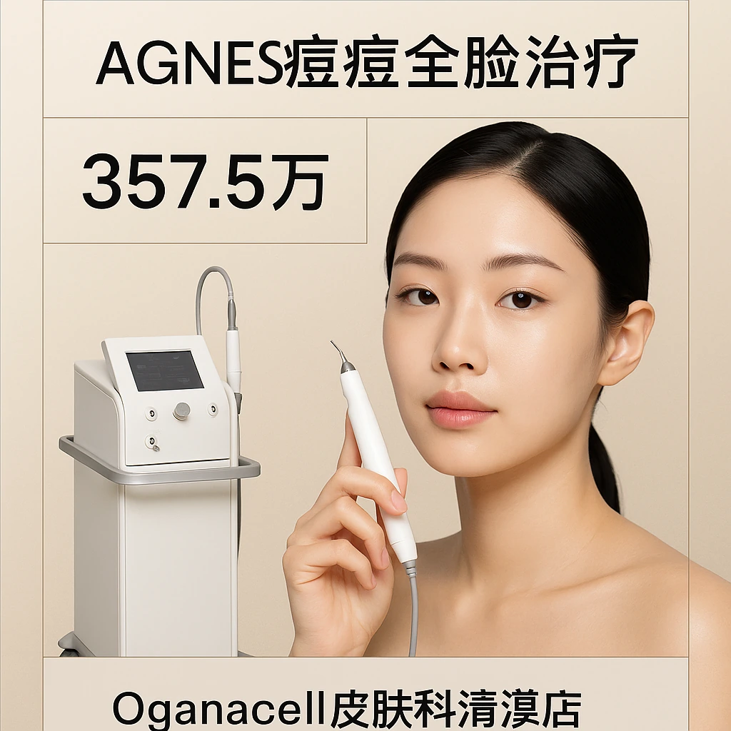 AGNES痘痘全脸治疗