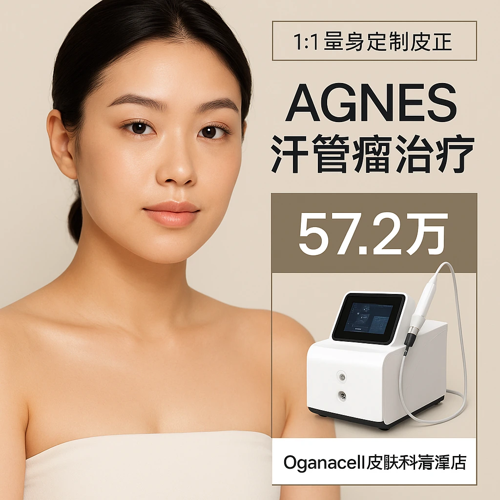 AGNES汗管瘤治疗