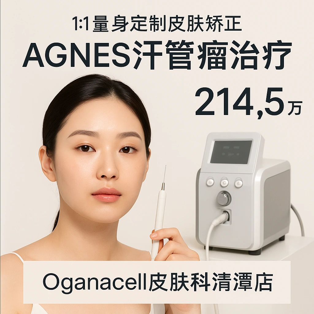 AGNES汗管瘤治疗