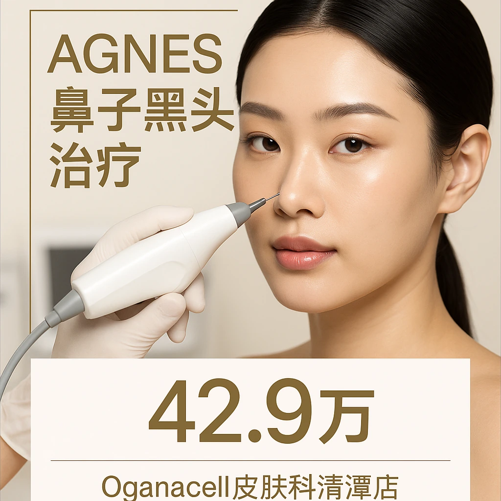 AGNES鼻子黑头治疗