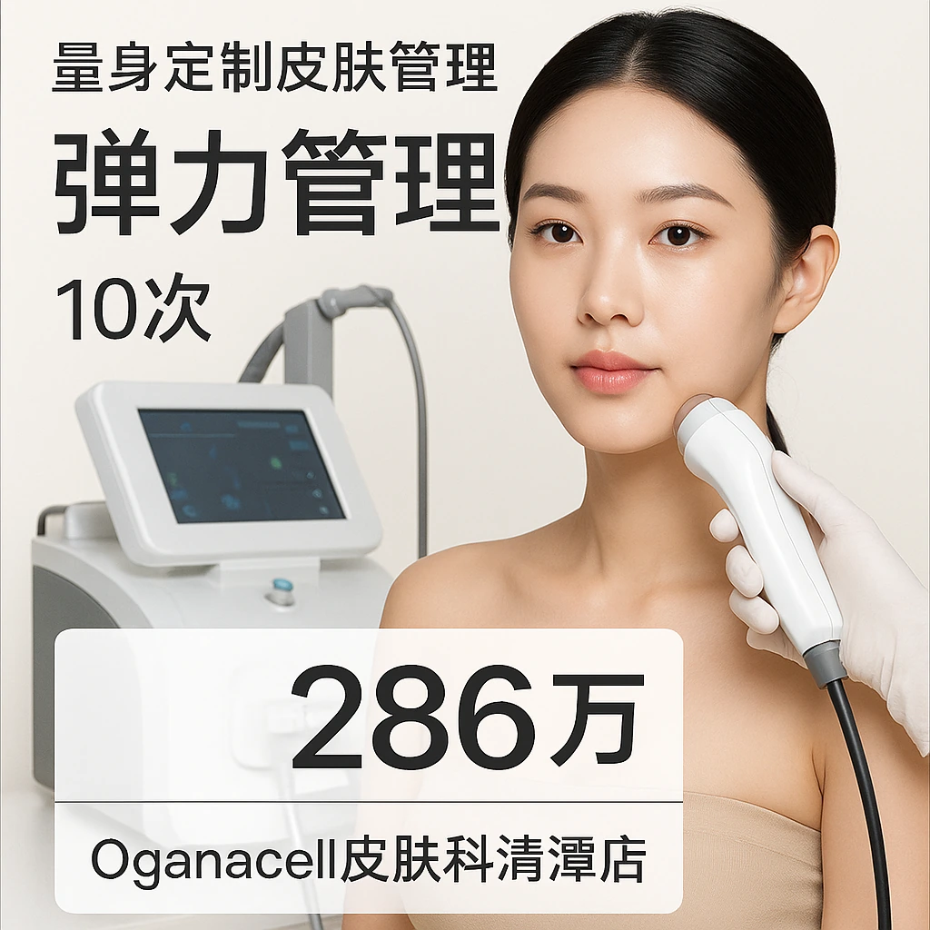 弹力管理