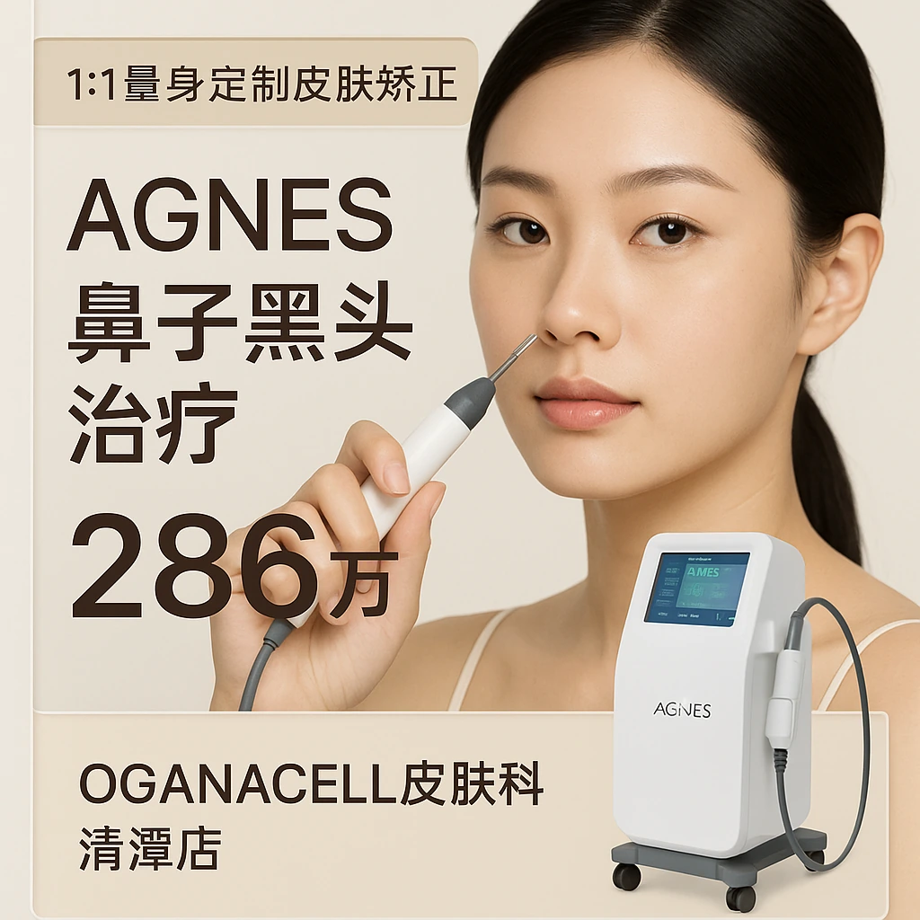 AGNES鼻子黑头治疗