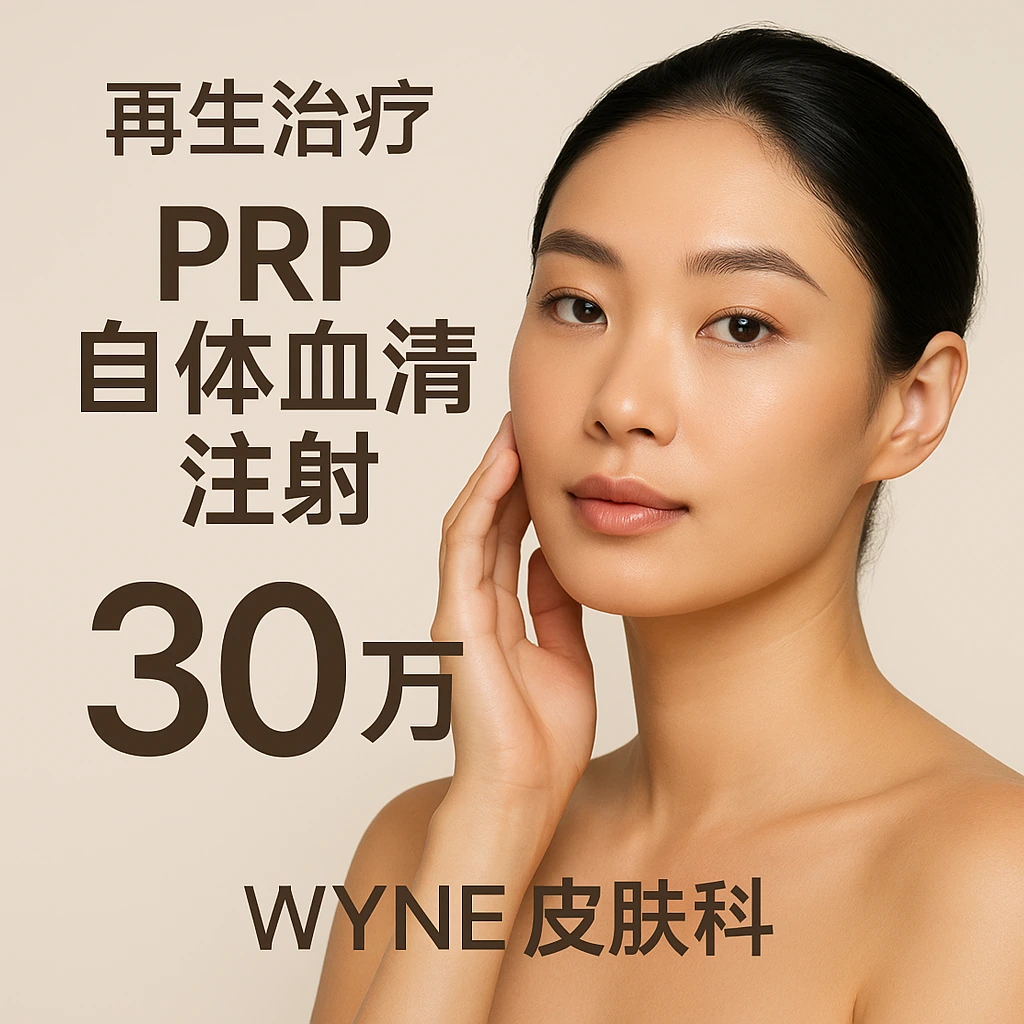PRP自体血清注射