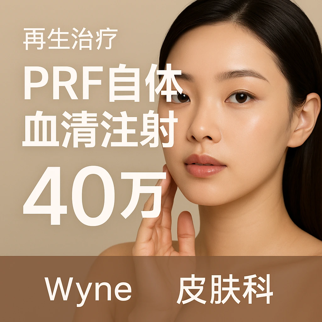 PRF自体血清注射
