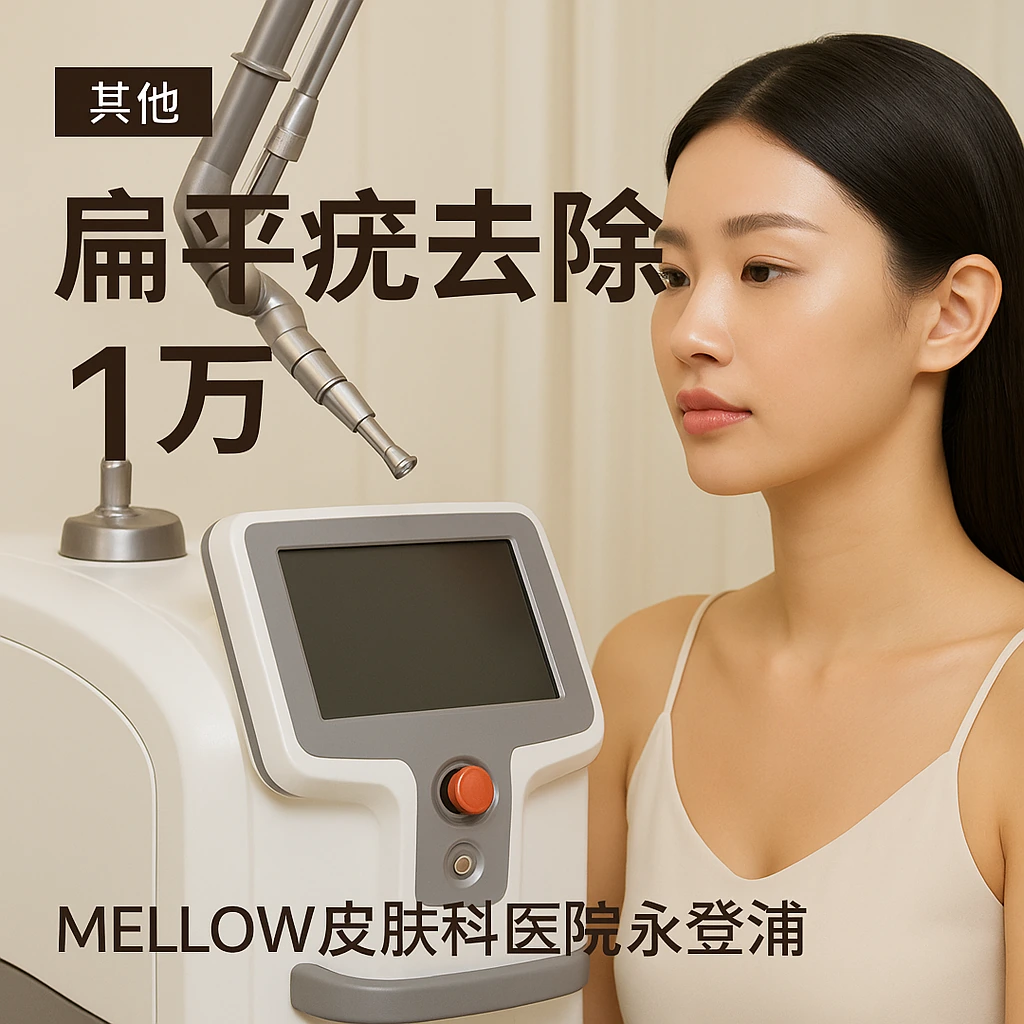 扁平疣去除