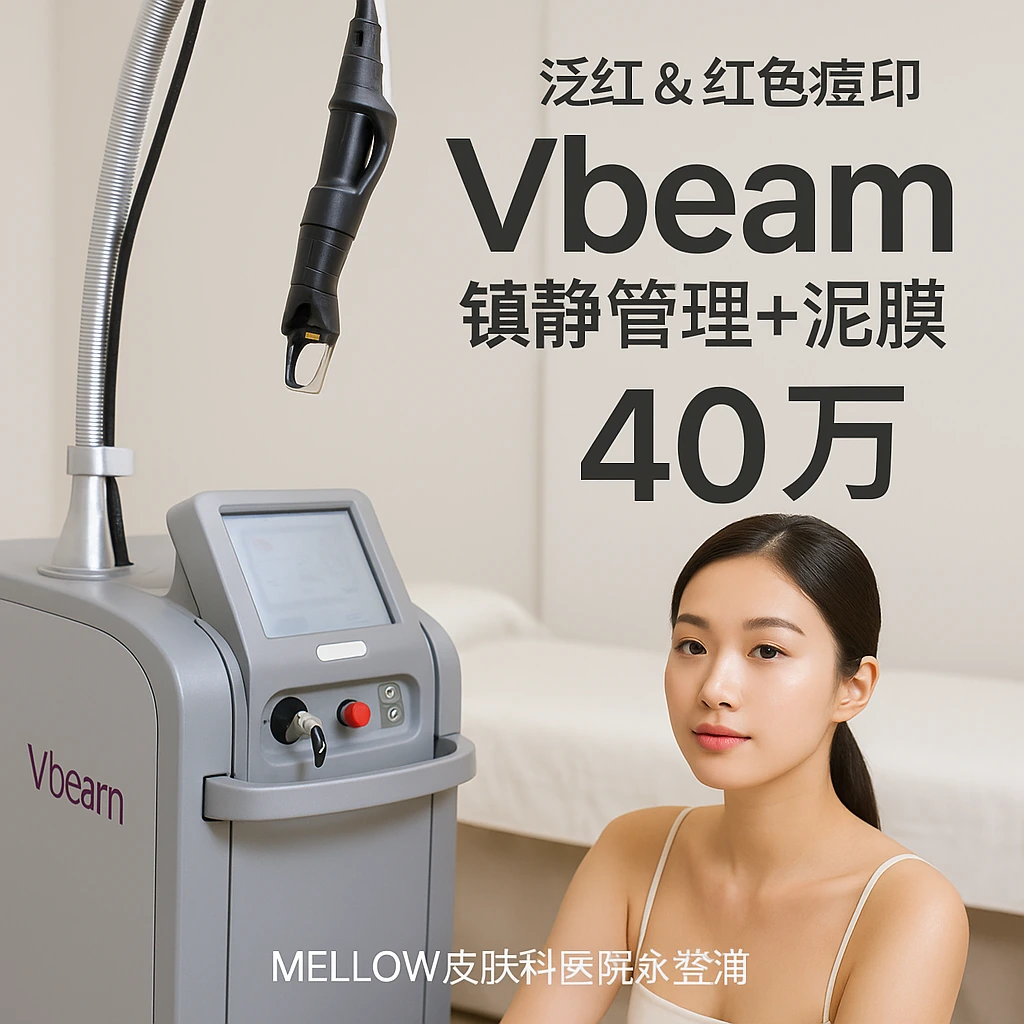 Vbeam (镇静管理+泥膜)