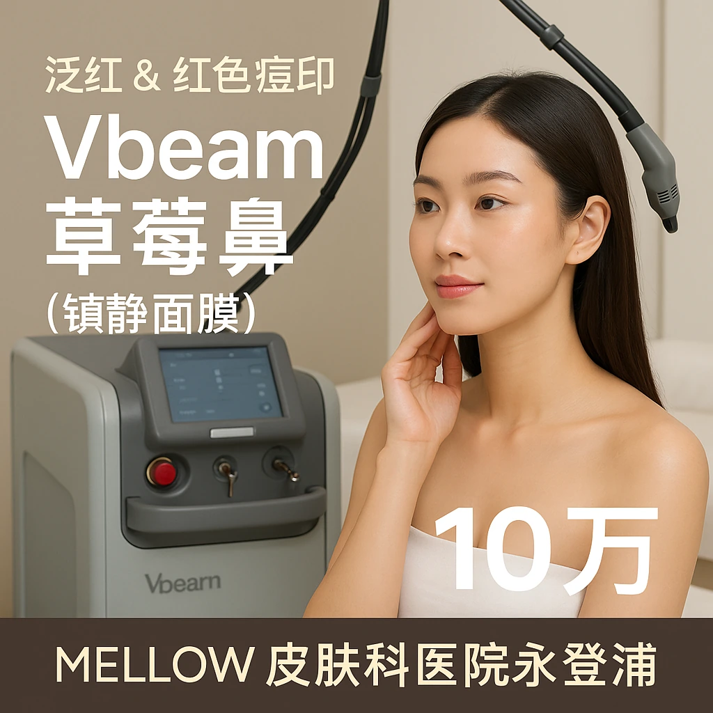 Vbeam 草莓鼻 (镇静面膜)