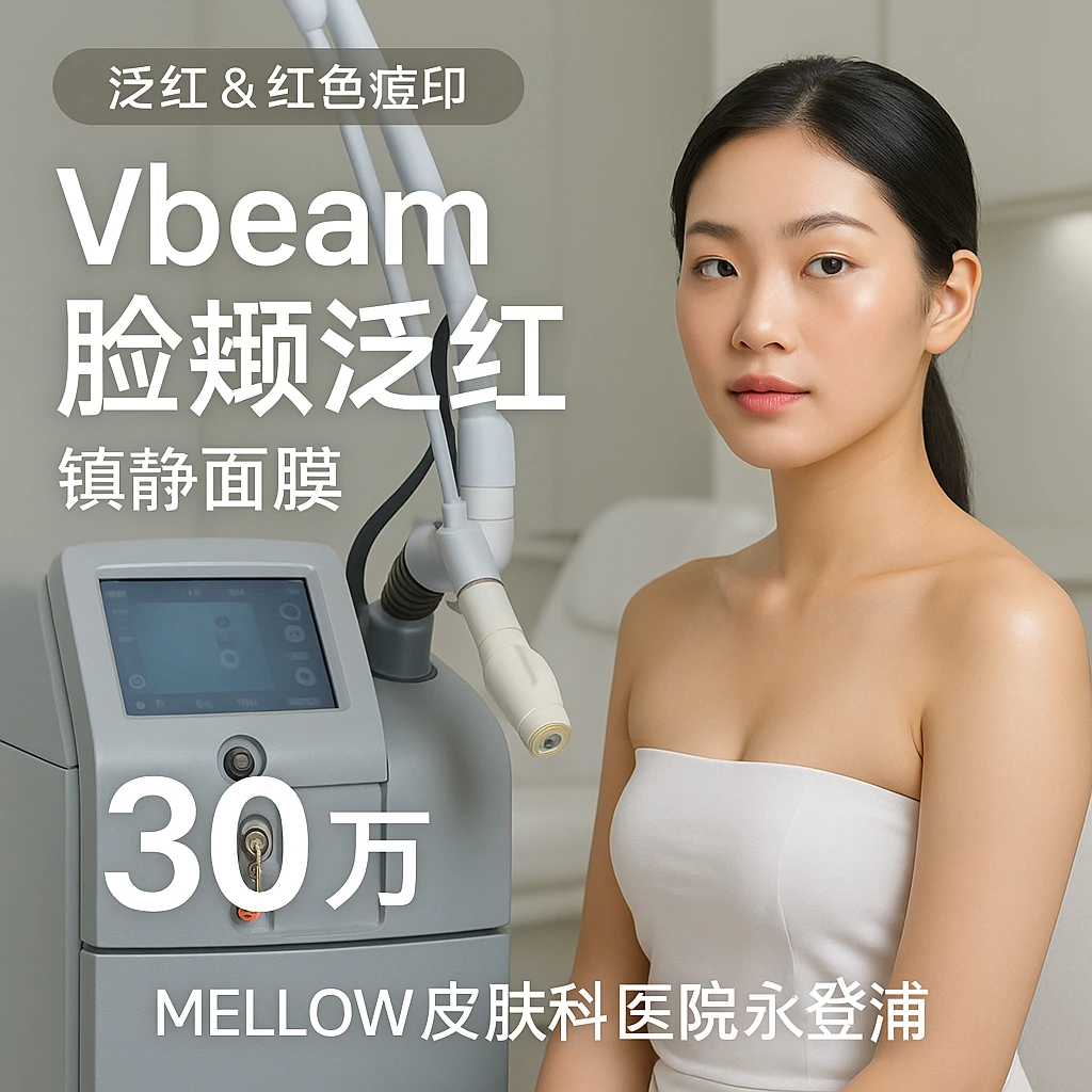 Vbeam 脸颊泛红 (镇静面膜)
