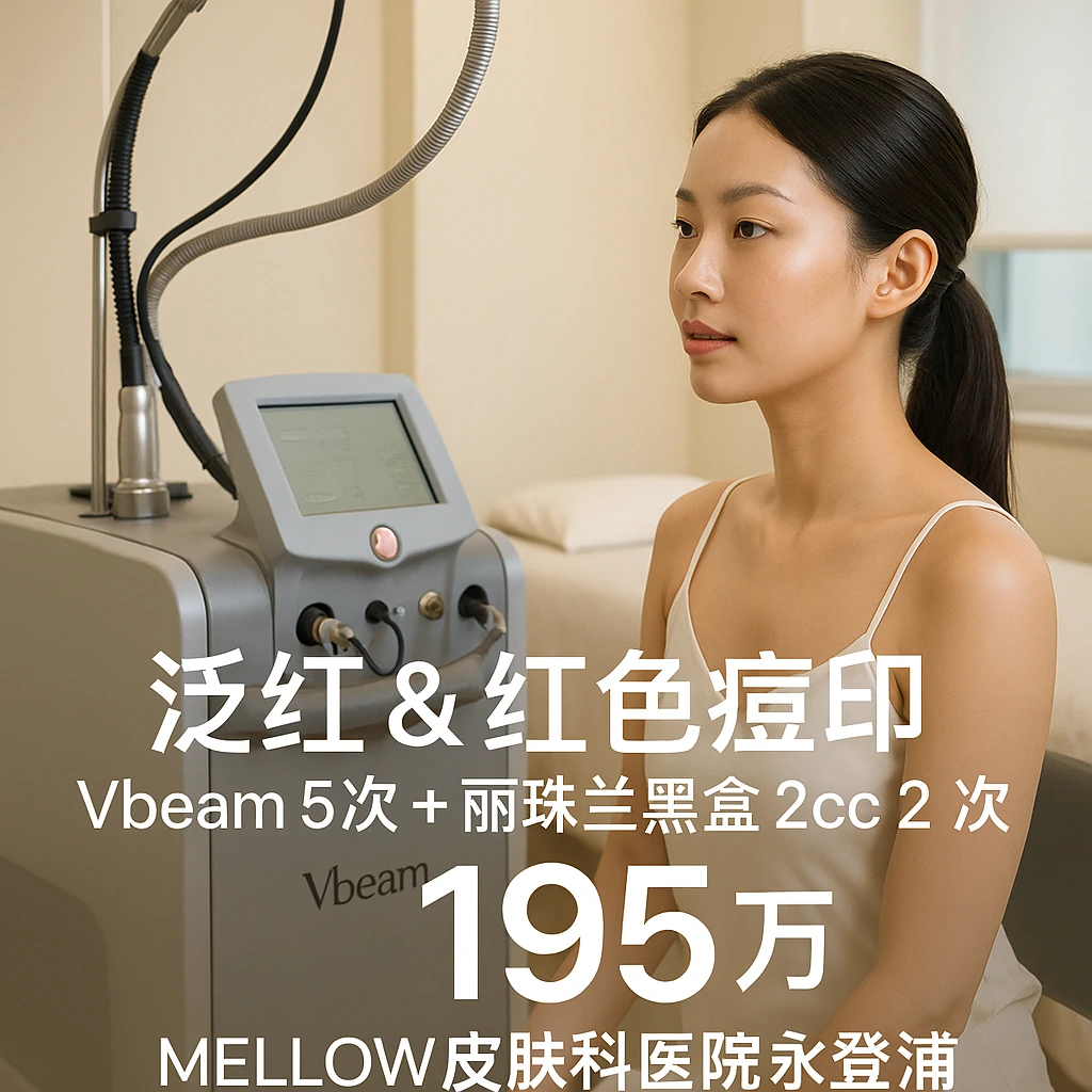 Vbeam 5次 + 丽珠兰黑盒 2cc 2次