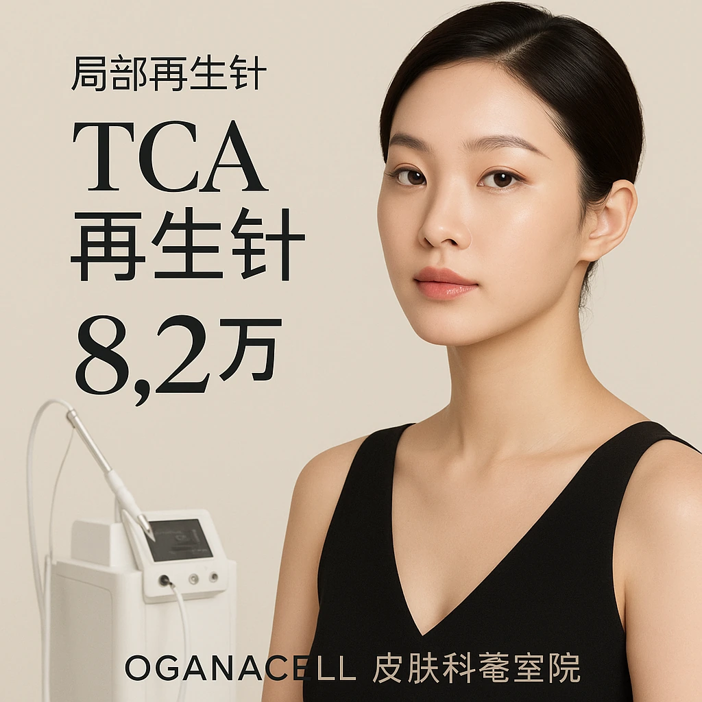 TCA再生针
